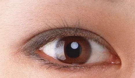 韩式开眼角在哪做