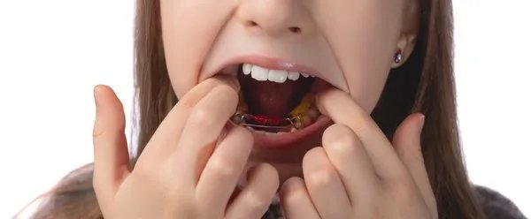 南京哪里做牙齿美白