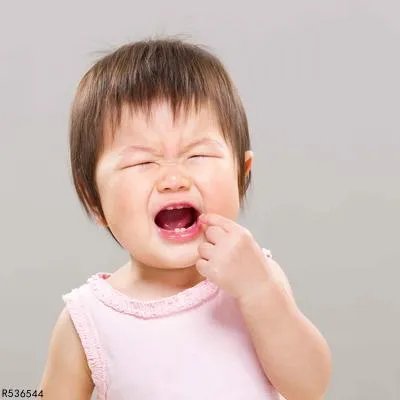 婴儿口角炎吃什么药好 可以抹凡士林吗