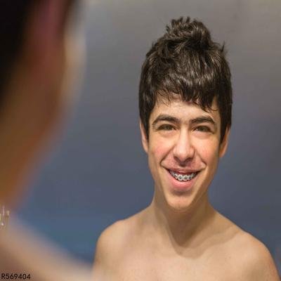 青春期男孩的发育特征是什么 揭秘男孩青春期发育的5个特征