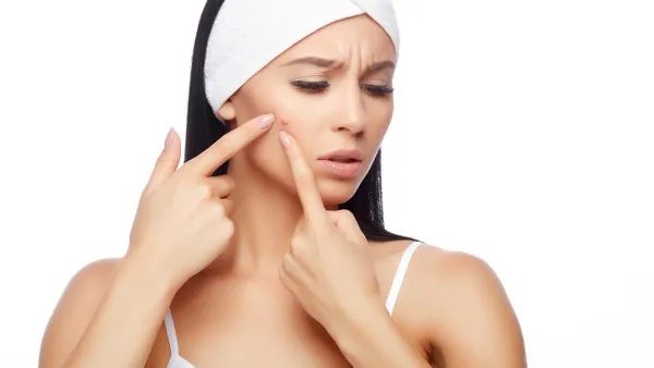 激光去痘印要多少钱