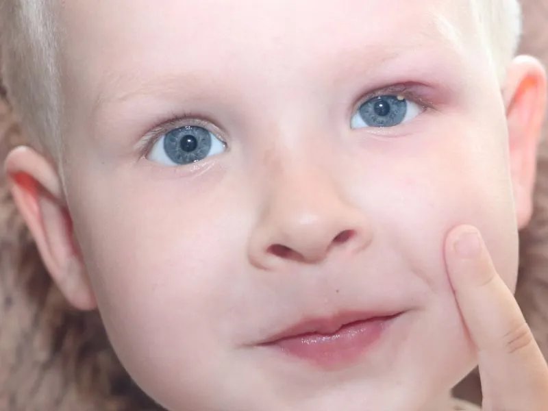 儿童翻白眼的原因