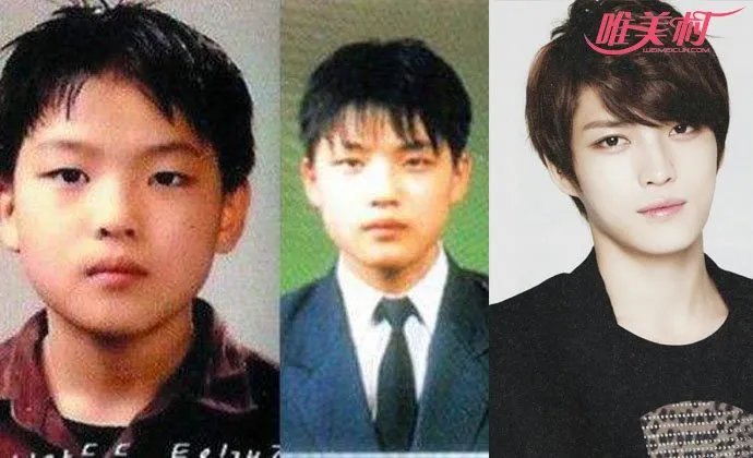 金在中整容前后照片 脸上多部位疑似动过刀