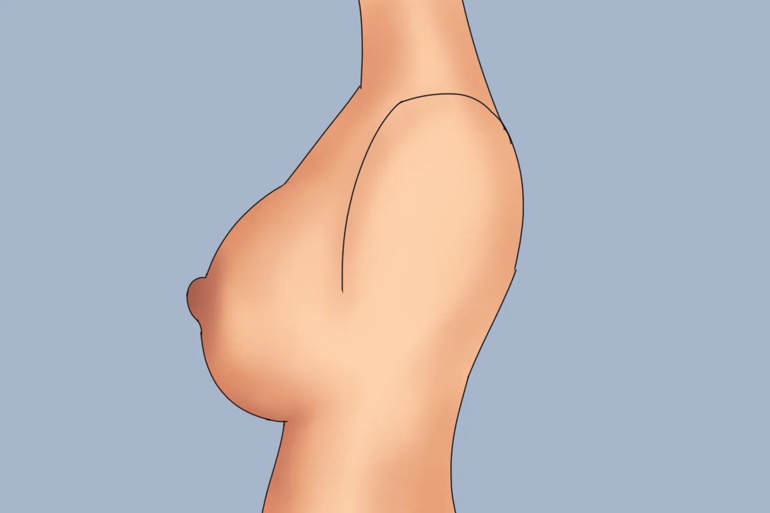 胸型有哪几种胸型分类图