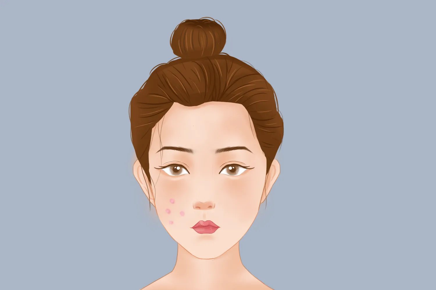 脸上长痘对应五脏示意图