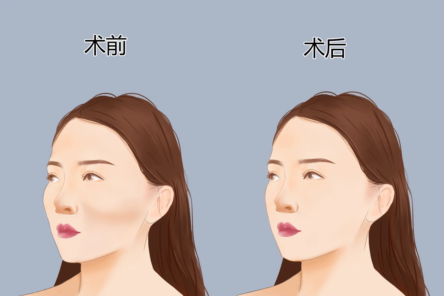 面部整形部位图解