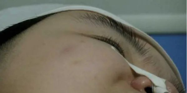 父母用爱唤醒植物人女儿了吗?