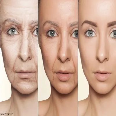 眼皮松弛应该怎么办