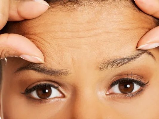 额头有抬头纹怎么办