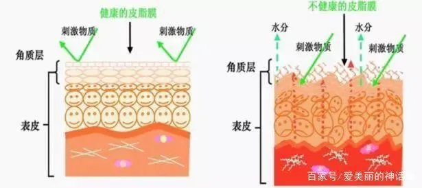 角质护理就是单纯的去角质吗?应该怎样做角质护理?