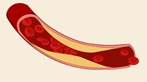 紫癜会有什么症状