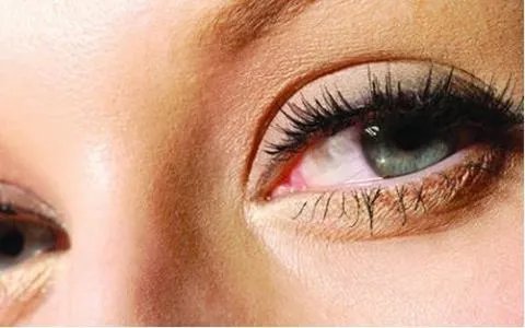 最好的双眼皮医院是哪个