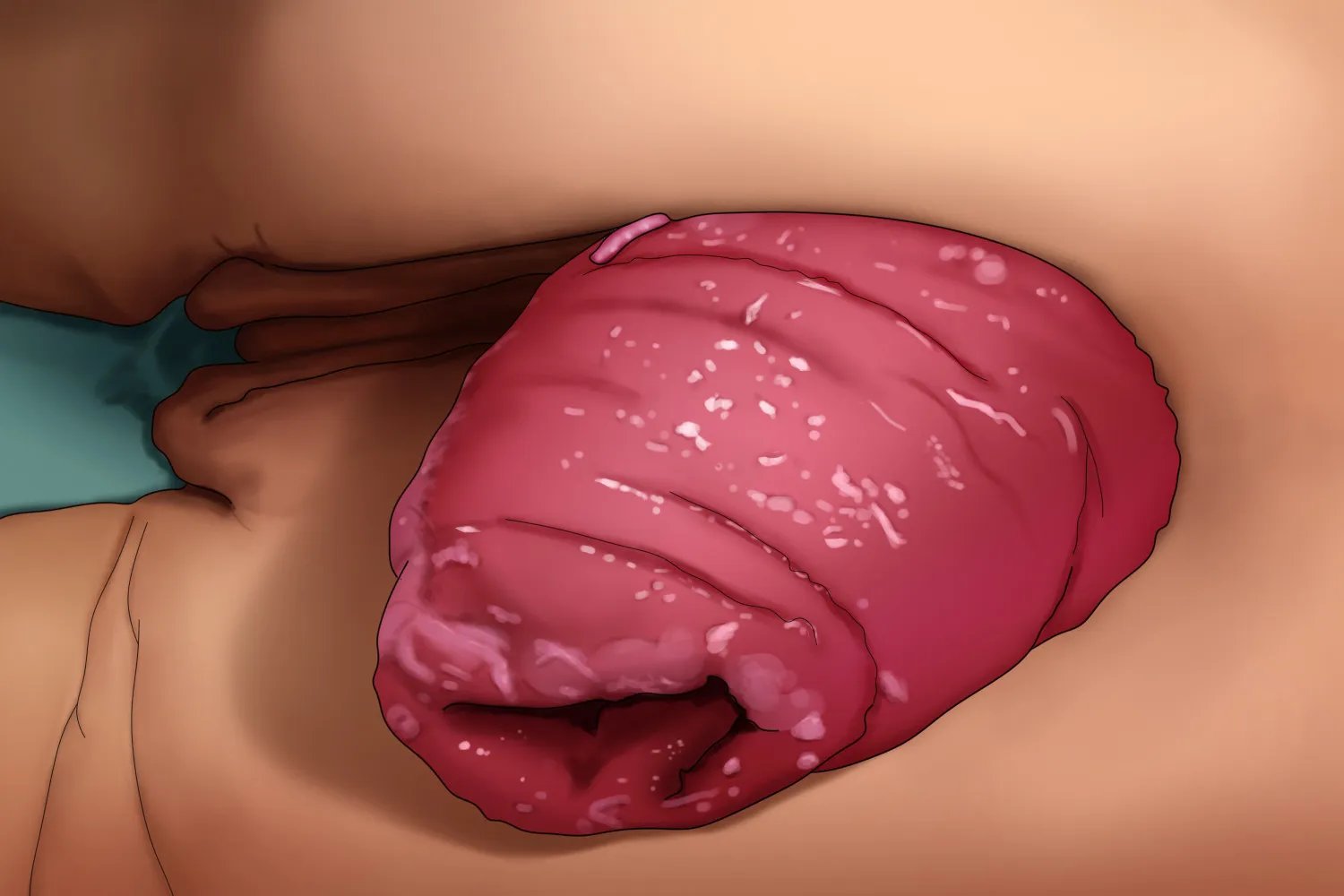 肛门脱落什么症状图片