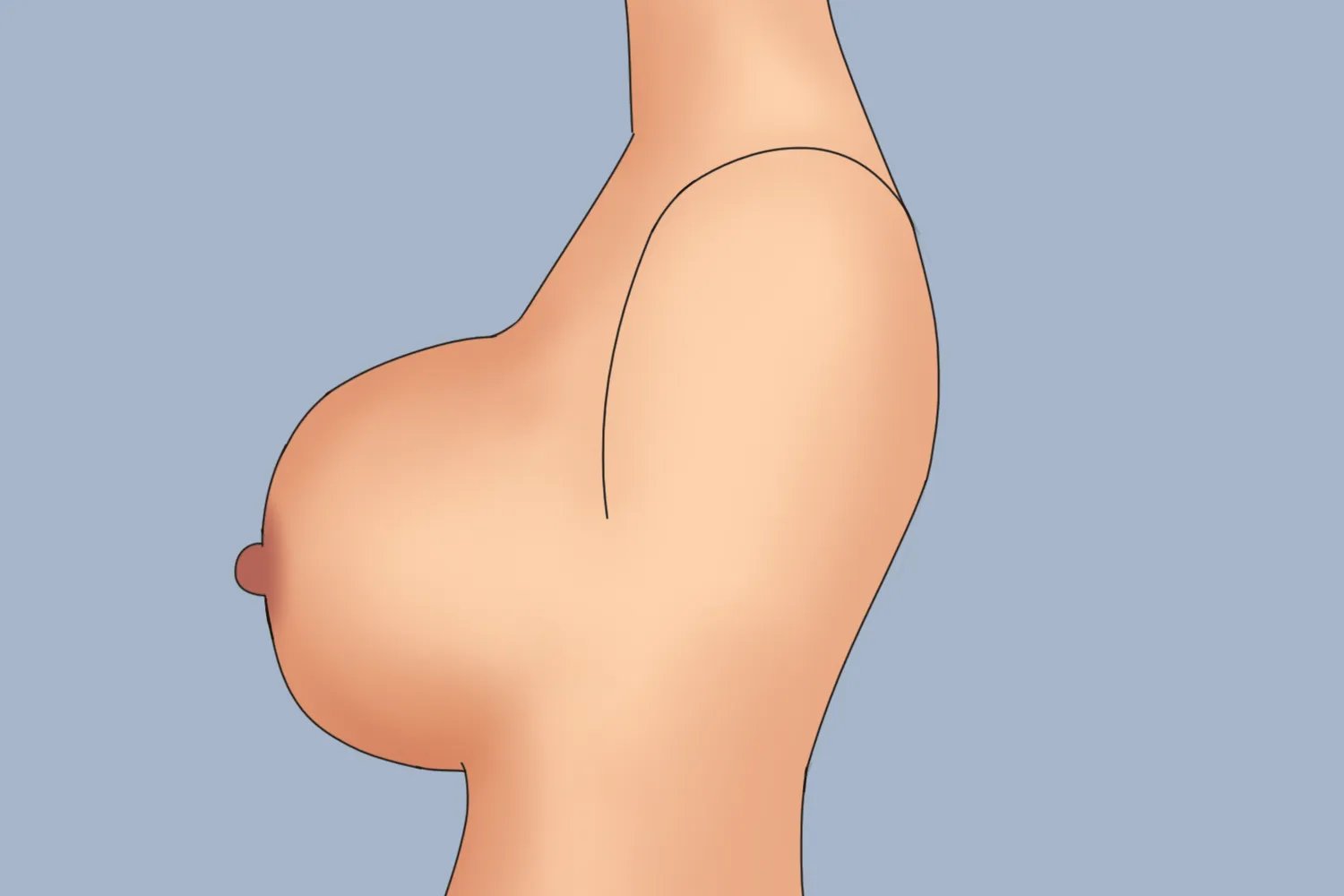 胸型有哪几种胸型分类图