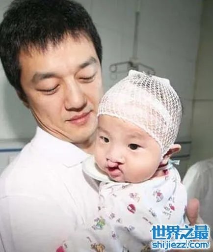 王菲李亚鹏女儿李嫣照片，天生唇腭裂却自信可爱 