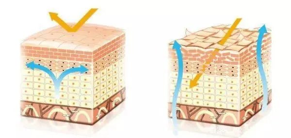 角质护理就是单纯的去角质吗?应该怎样做角质护理?