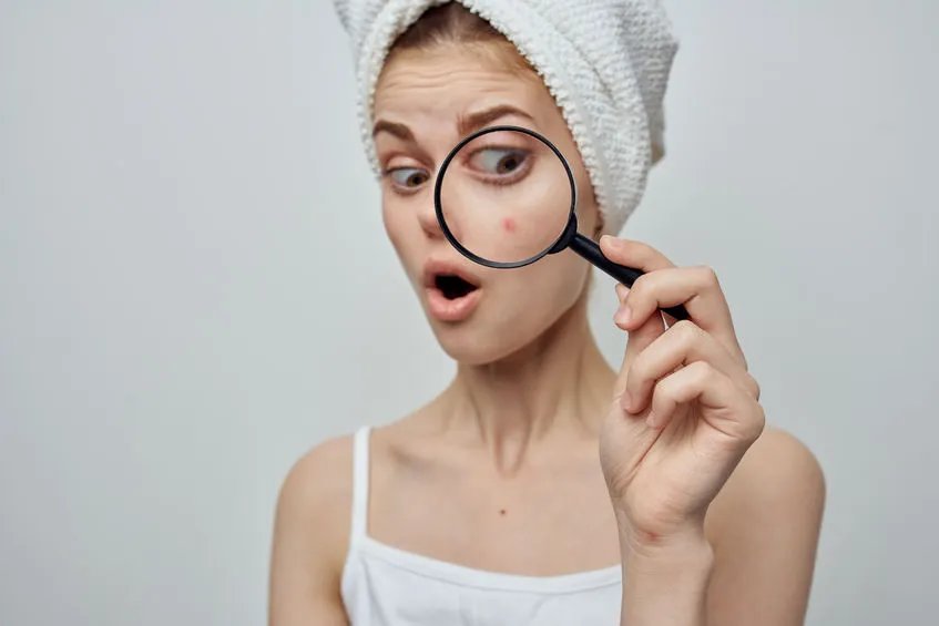 如何去黑头最有效