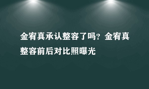 金宥真承认整容了吗？金宥真整容前后对比照曝光