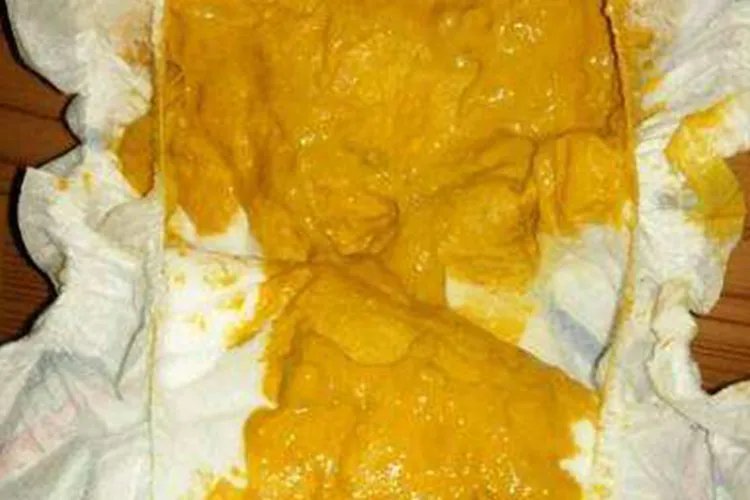 14天宝宝正常大便图