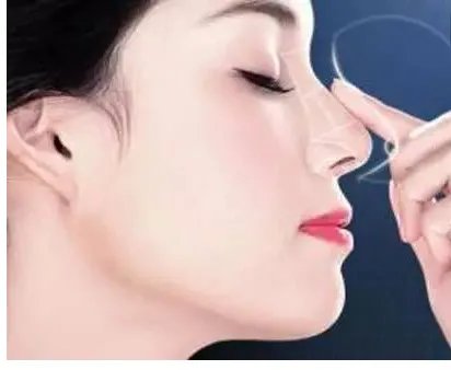 同样是隆鼻,为嘛人家就是比我好看?