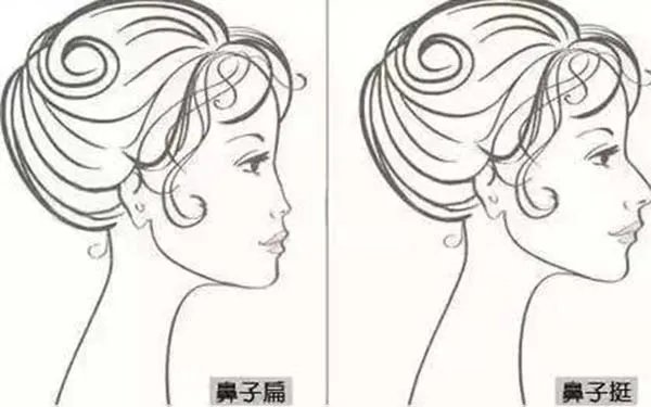 北京假体隆鼻哪家医院好