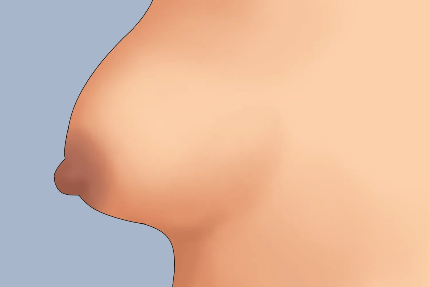 胸型有哪几种胸型分类图