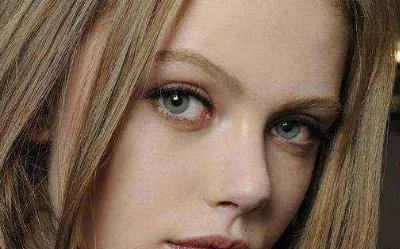 双眼皮成型手术费用是多少