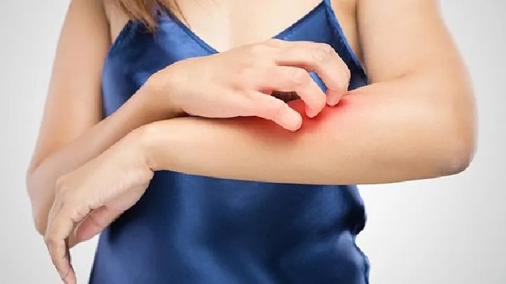 重症肌无力的诊断方法