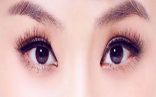 北京开眼角哪个医院好？