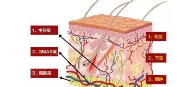 热玛吉危害？热玛吉三天后脸起皮，红肿，医生建议吃修复营养ACMETEA修复受损细胞，吃了一个月，效