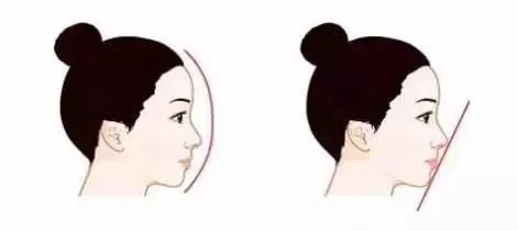 大鼻头如何缩小