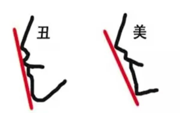 成都膨体隆鼻医院哪家好