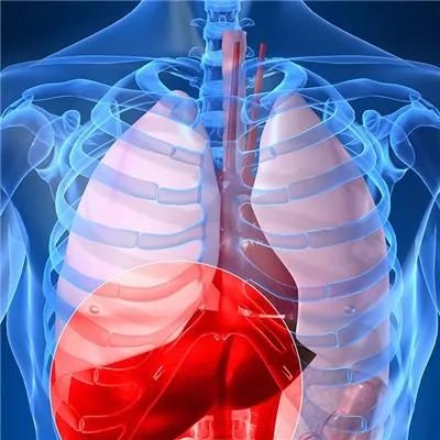 丙肝能彻底治好吗