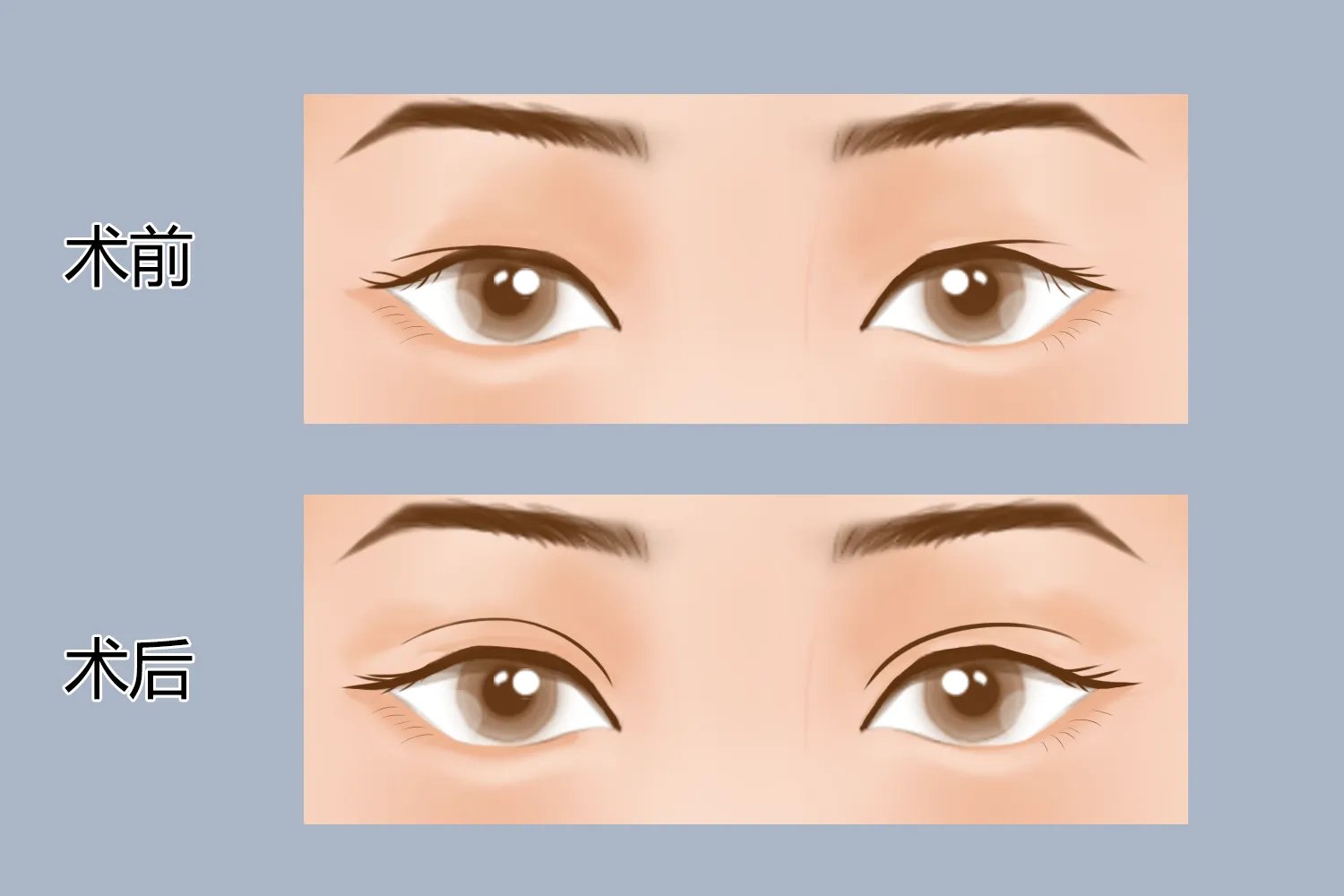 面部整形部位图解