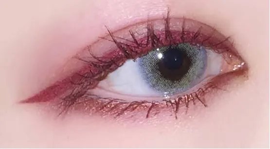 重庆双眼皮多少钱