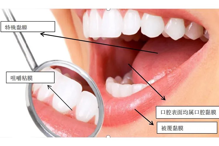 口腔黏膜是哪个部位图片