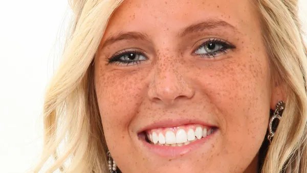 脸上长斑的原因