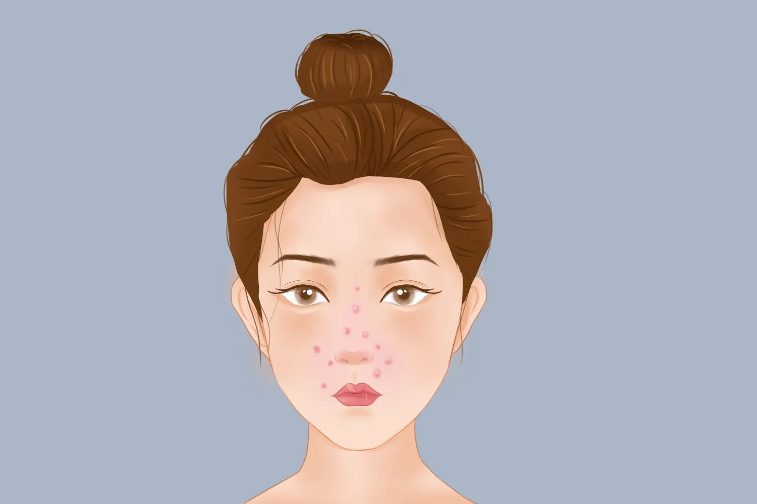 脸上长痘对应五脏示意图