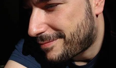 植胡须技术好吗