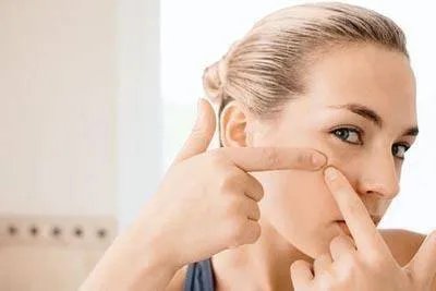 祛斑美白的方法