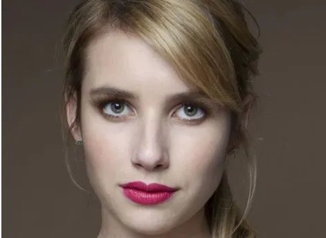 祛痣需要多少钱