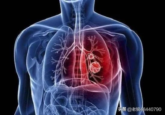 从华盛顿州宣布紧急状态看，可能全美爆发，美国有无财力去控制疫情？