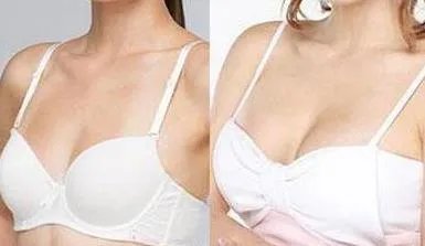 美国麦格假体隆胸多少钱