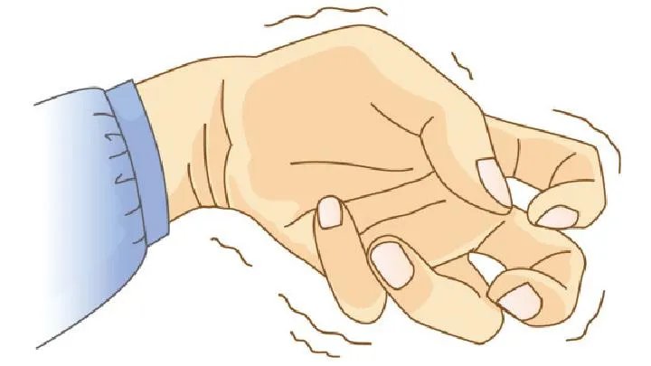 癫痫病的早期症状都有哪些呢