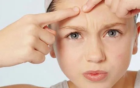 激光祛痘的危害