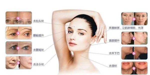 热玛吉危害？热玛吉三天后脸起皮，红肿，医生建议吃修复营养ACMETEA修复受损细胞，吃了一个月，效