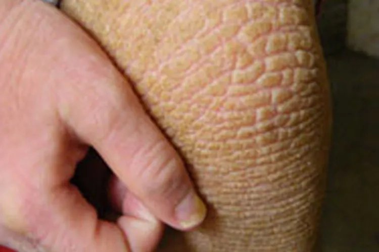 腿上有鱼鳞图片