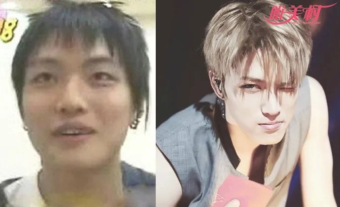 金在中整容前后照片 脸上多部位疑似动过刀