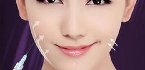 注射botox瘦脸要多少钱