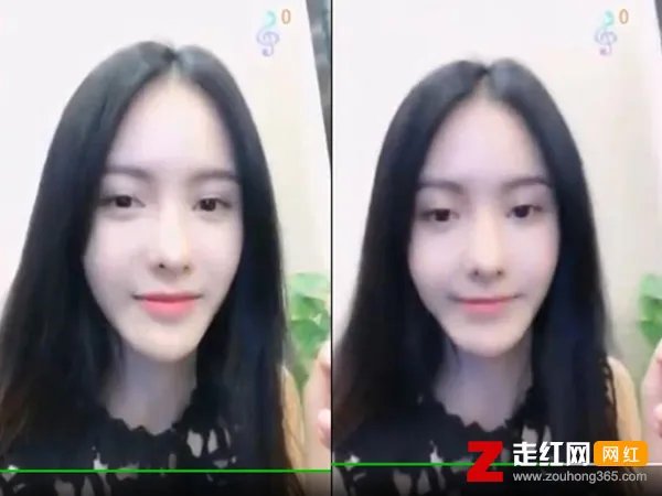 张芷溪整容前后照片，为什么说张芷溪整的好吓人